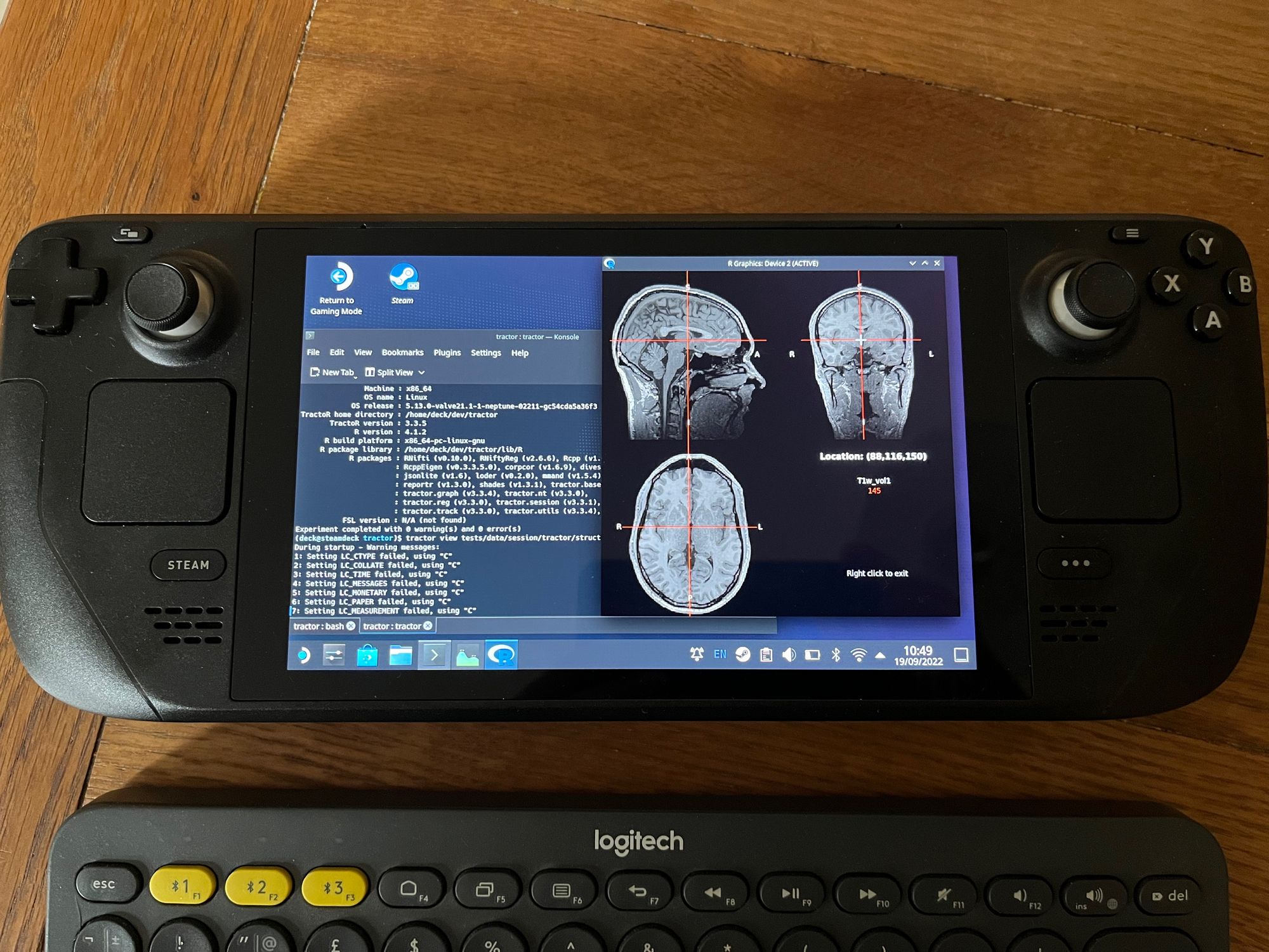 Steam Deck showing the medical imaging software TractoR running on its screen
